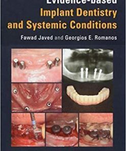 Evidence Based Implant Dentistry And Systemic Conditions