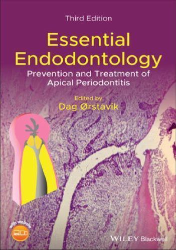 Essential Endodontology Prevention And Treatment Of Apical Periodontitis 3Rd