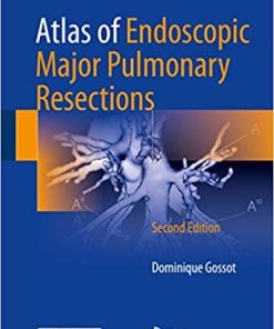 Atlas of Endoscopic Major Pulmonary Resections 2nd