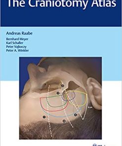 The Craniotomy Atlas