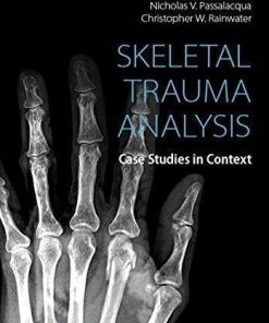 Skeletal Trauma Analysis Case Studies In Context