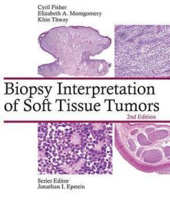 Biopsy Interpretation Of Soft Tissue Tumors 2Nd