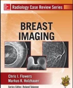 Radiology Case Review Series Breast Imaging