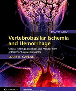 Vertebrobasilar Ischemia and Hemorrhage Clinical Findings Diagnosis and Management of Posterior Circulation Disease 2