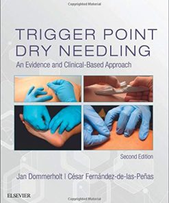Trigger Point Dry Needling An Evidence and ClinicalBased Approach 8211 2nd