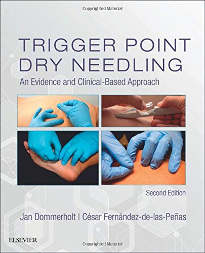 Trigger Point Dry Needling An Evidence and ClinicalBased Approach 8211 2nd