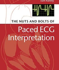 The Nuts and bolts of Paced ECG Interpretation Nuts and Bolts Series 8211 1st