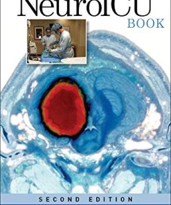The NeuroICU Book 8211 2nd