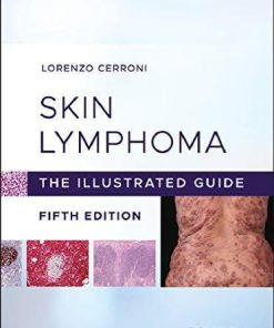 Skin Lymphoma The Illustrated Guide 5Th