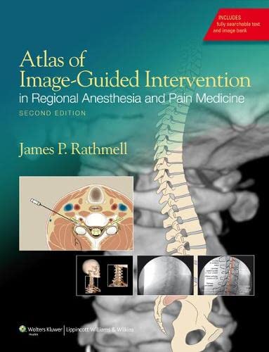 Atlas of ImageGuided Intervention in Regional Anesthesia and Pain Medicine 8211 2nd