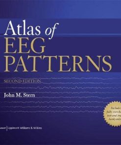 Atlas of EEG Patterns