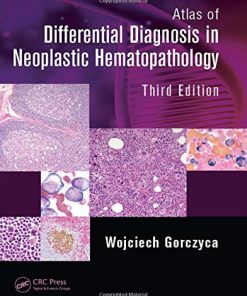 Atlas of differential diagnosis in neoplastic hematopathology