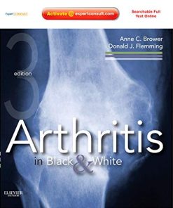 Arthritis in Black and White