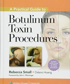 A practical guide to botulinum toxin injections 8211 1st