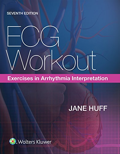 ECG Workout Exercises in Arrhythmia Interpretation 7th