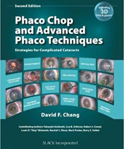 Phaco Chop and Advanced Phaco Techniques Strategies for Complicated Cataracts 2nd