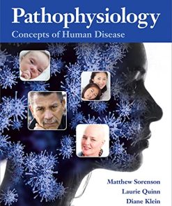 Pathophysiology Concepts of Human Disease