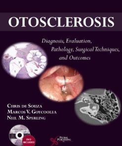 Otosclerosis Diagnosis Evaluation Pathology Surgical Techniques And Outcomes